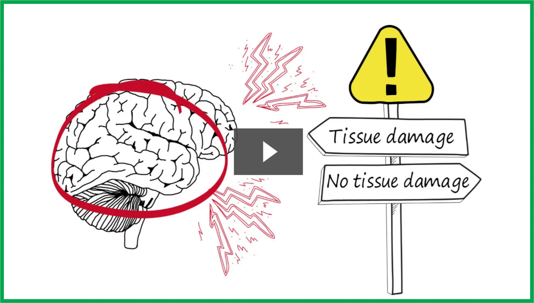 Chronic Pain and getting rid of it studies, video animation