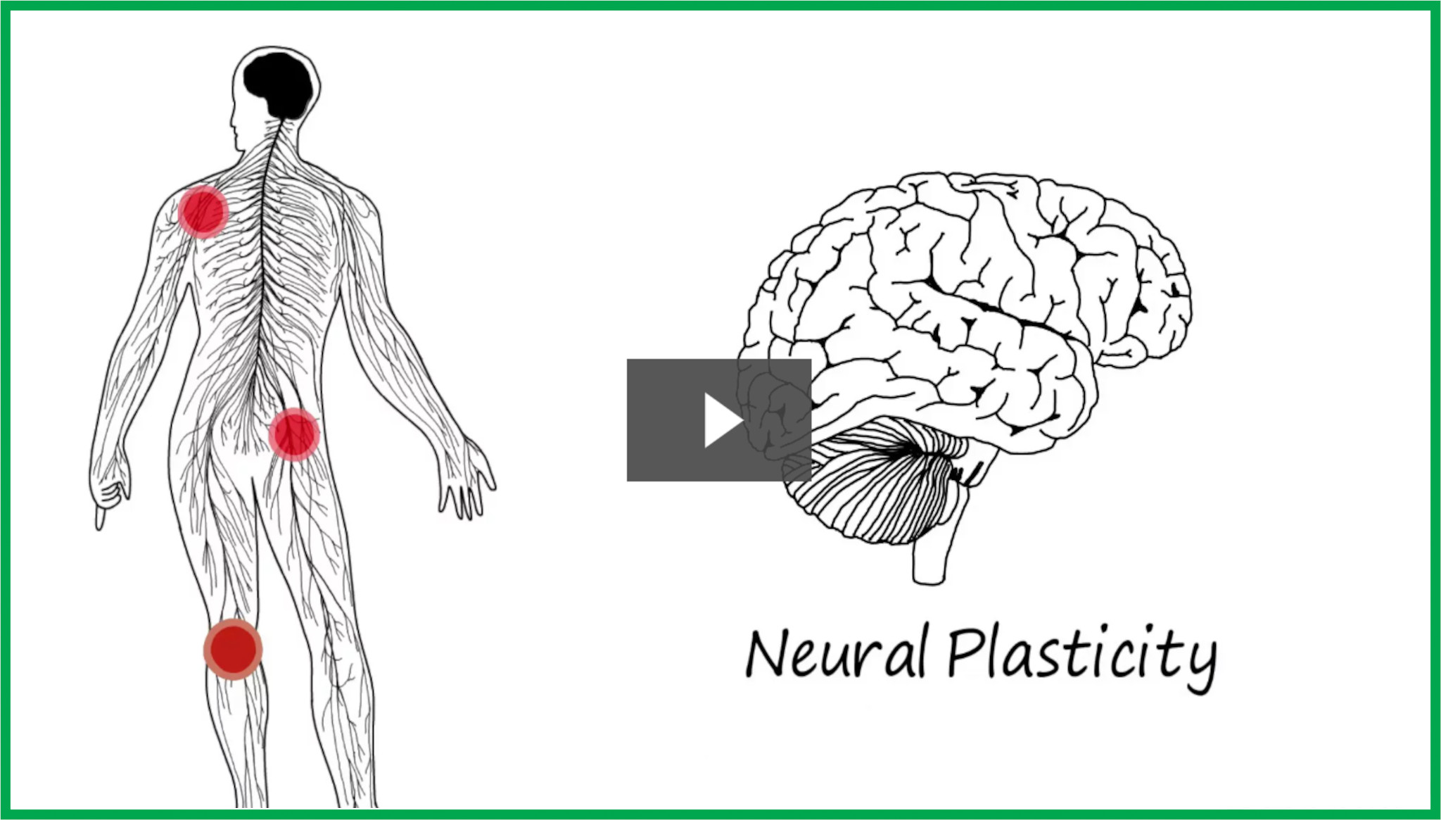 Animated video of studies re pain and chiropractic care effects